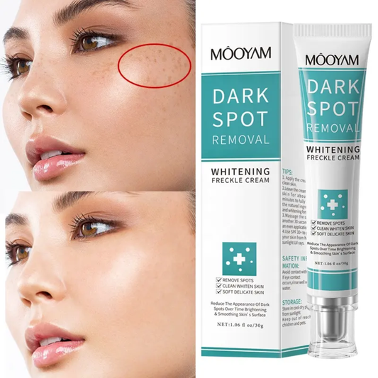 Mooyam Dark Spot Remover for Face | Brightening Serum for Hyperpigmentation & Uneven Skin Tone