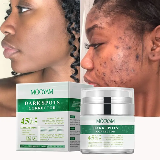 MOOYAM Dark Spots Corrector Cream - Advanced Whitening for Freckles, Melanin, & Uneven Skin Tone